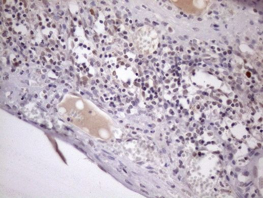 ZC3H8 Antibody in Immunohistochemistry (Paraffin) (IHC (P))