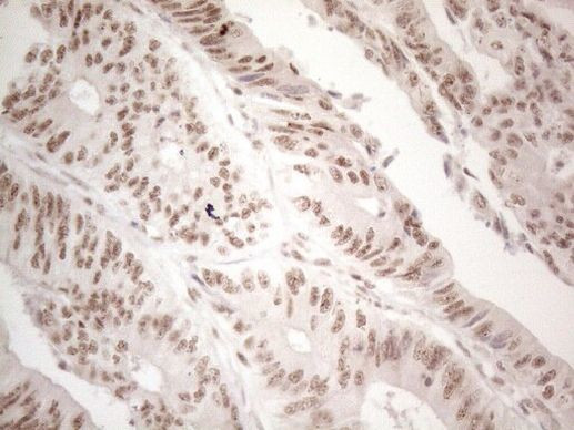 WTAP Antibody in Immunohistochemistry (Paraffin) (IHC (P))