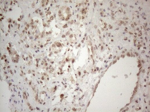 WTAP Antibody in Immunohistochemistry (Paraffin) (IHC (P))