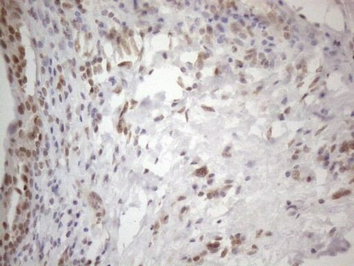 WTAP Antibody in Immunohistochemistry (Paraffin) (IHC (P))