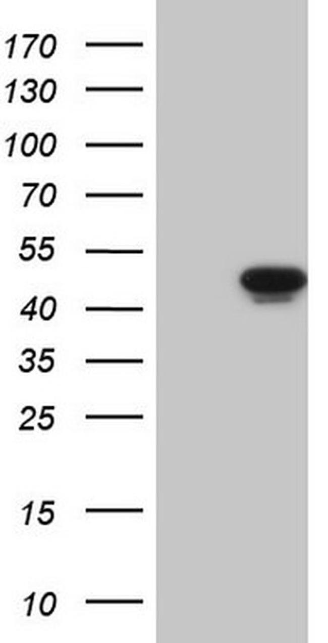 WTAP Antibody in Western Blot (WB)