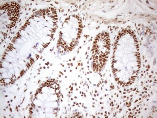 WTAP Antibody in Immunohistochemistry (Paraffin) (IHC (P))