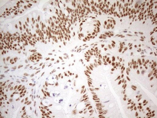 WTAP Antibody in Immunohistochemistry (Paraffin) (IHC (P))