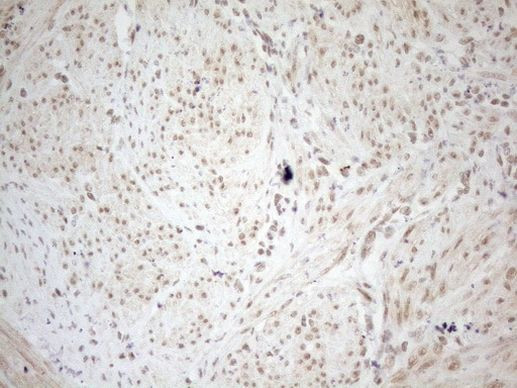 WTAP Antibody in Immunohistochemistry (Paraffin) (IHC (P))