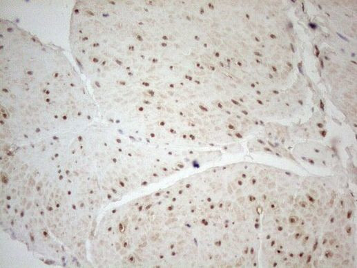 WTAP Antibody in Immunohistochemistry (Paraffin) (IHC (P))