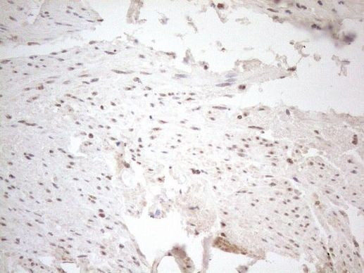 WTAP Antibody in Immunohistochemistry (Paraffin) (IHC (P))