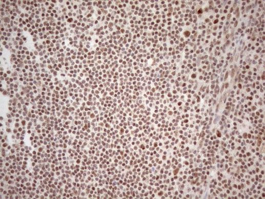 WTAP Antibody in Immunohistochemistry (Paraffin) (IHC (P))