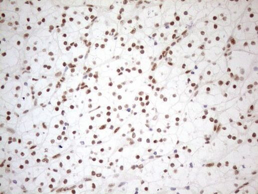 WTAP Antibody in Immunohistochemistry (Paraffin) (IHC (P))