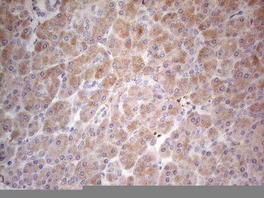 PPA2 Antibody in Immunohistochemistry (Paraffin) (IHC (P))