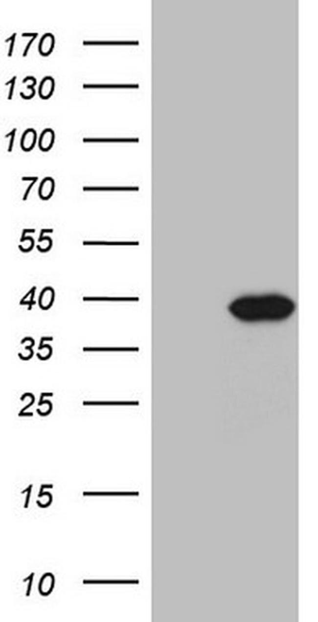 PPA2 Antibody in Western Blot (WB)