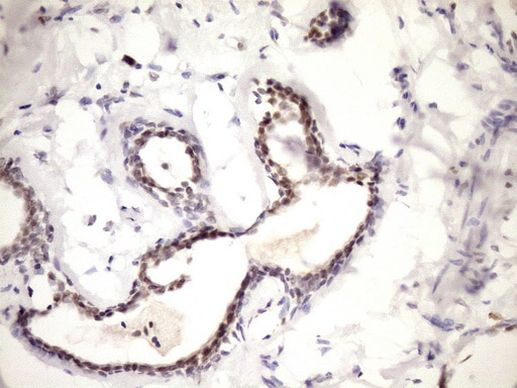 WTAP Antibody in Immunohistochemistry (Paraffin) (IHC (P))