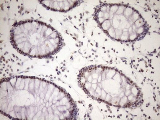 WTAP Antibody in Immunohistochemistry (Paraffin) (IHC (P))