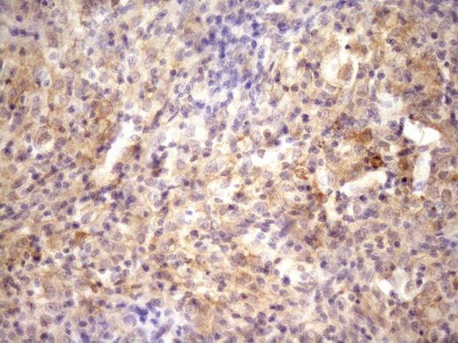 RAB11FIP4 Antibody in Immunohistochemistry (Paraffin) (IHC (P))