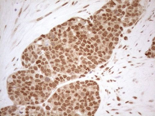 RGL2 Antibody in Immunohistochemistry (Paraffin) (IHC (P))