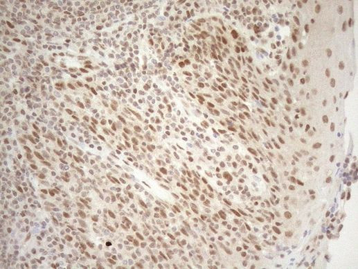 RGL2 Antibody in Immunohistochemistry (Paraffin) (IHC (P))