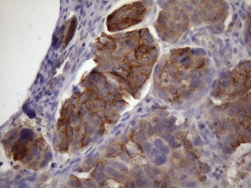 XRCC6BP1 Antibody in Immunohistochemistry (Paraffin) (IHC (P))