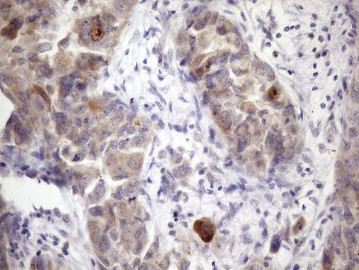 XRCC6BP1 Antibody in Immunohistochemistry (Paraffin) (IHC (P))