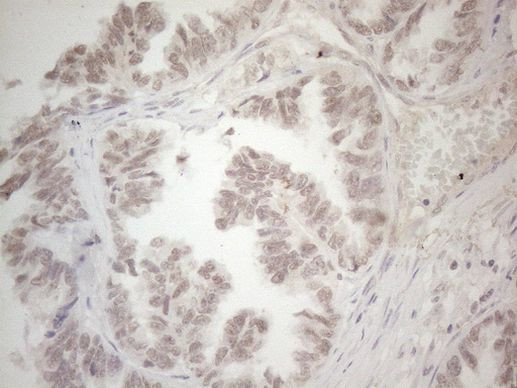 SPT3 Antibody in Immunohistochemistry (Paraffin) (IHC (P))