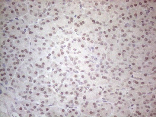 SPT3 Antibody in Immunohistochemistry (Paraffin) (IHC (P))