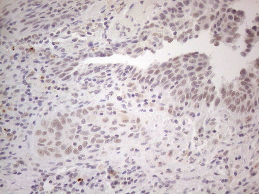 SPT3 Antibody in Immunohistochemistry (Paraffin) (IHC (P))