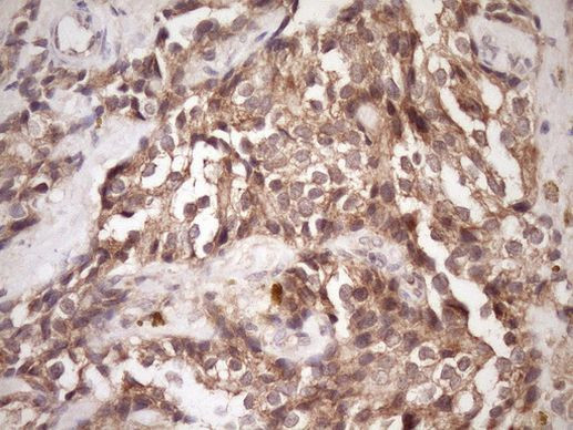 PIN4 Antibody in Immunohistochemistry (Paraffin) (IHC (P))