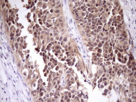 PIN4 Antibody in Immunohistochemistry (Paraffin) (IHC (P))