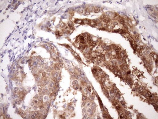 PIN4 Antibody in Immunohistochemistry (Paraffin) (IHC (P))