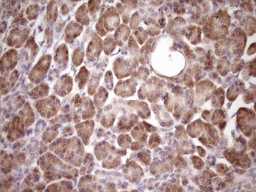 PIN4 Antibody in Immunohistochemistry (Paraffin) (IHC (P))