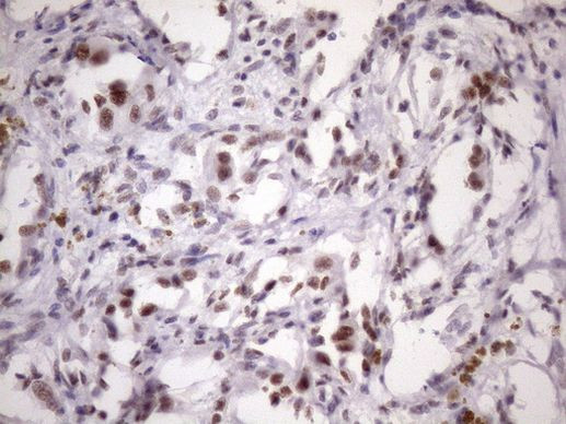 SRSF9 Antibody in Immunohistochemistry (Paraffin) (IHC (P))