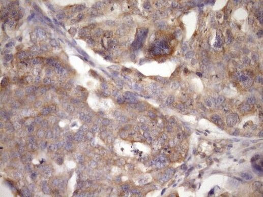 TRBP Antibody in Immunohistochemistry (Paraffin) (IHC (P))