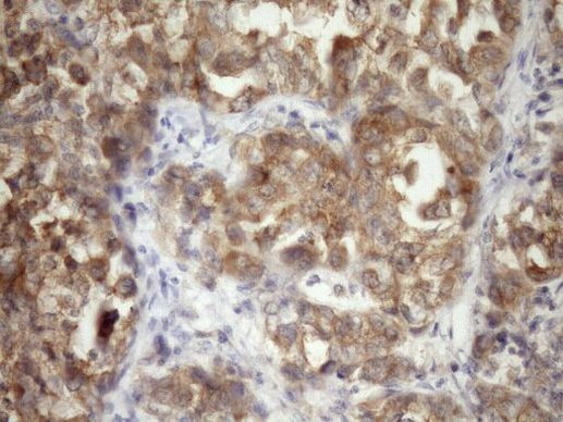 TRBP Antibody in Immunohistochemistry (Paraffin) (IHC (P))