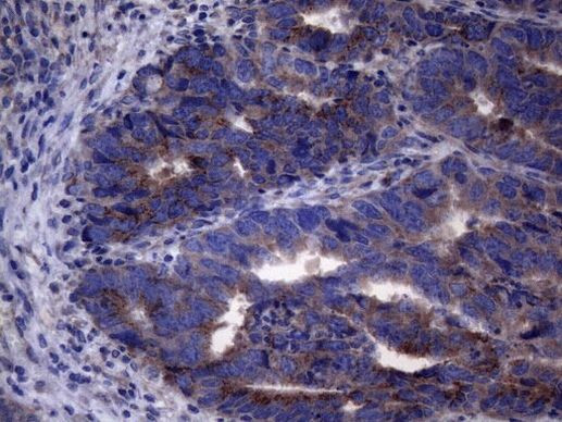 AKIP1 Antibody in Immunohistochemistry (Paraffin) (IHC (P))