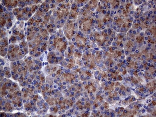 AKIP1 Antibody in Immunohistochemistry (Paraffin) (IHC (P))