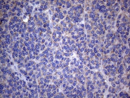 AKIP1 Antibody in Immunohistochemistry (Paraffin) (IHC (P))