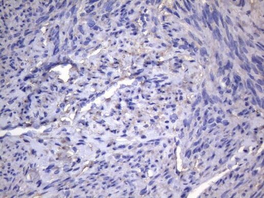 AKIP1 Antibody in Immunohistochemistry (Paraffin) (IHC (P))