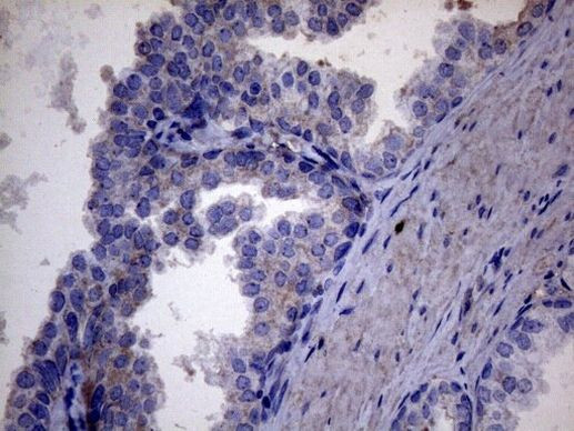 AKIP1 Antibody in Immunohistochemistry (Paraffin) (IHC (P))