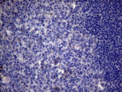 AKIP1 Antibody in Immunohistochemistry (Paraffin) (IHC (P))