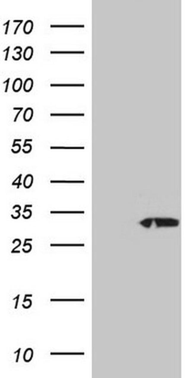 PSMG2 Antibody in Western Blot (WB)