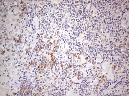 MARK4 Antibody in Immunohistochemistry (Paraffin) (IHC (P))