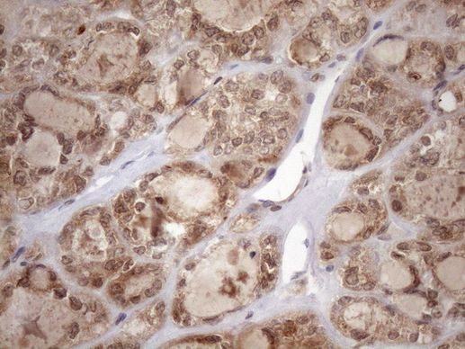 TDG Antibody in Immunohistochemistry (Paraffin) (IHC (P))