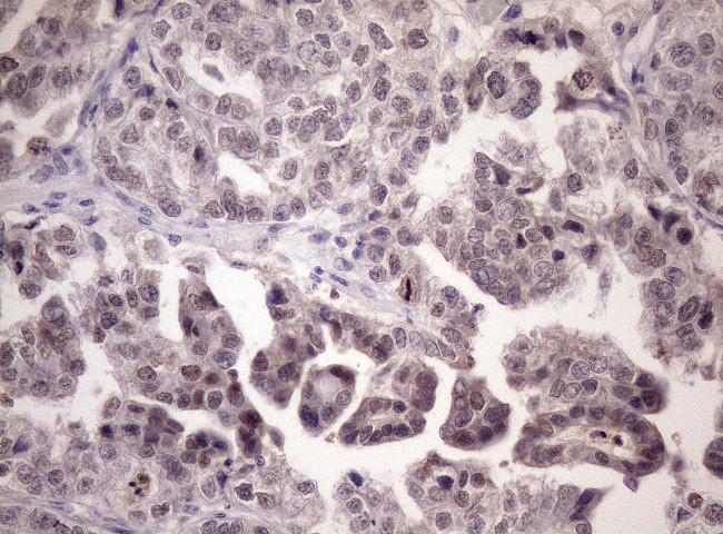 LELP1 Antibody in Immunohistochemistry (Paraffin) (IHC (P))