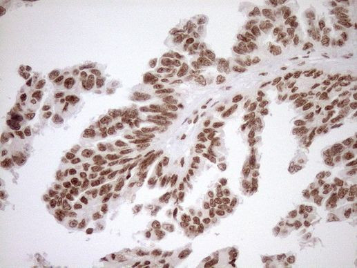 EXOSC1 Antibody in Immunohistochemistry (Paraffin) (IHC (P))