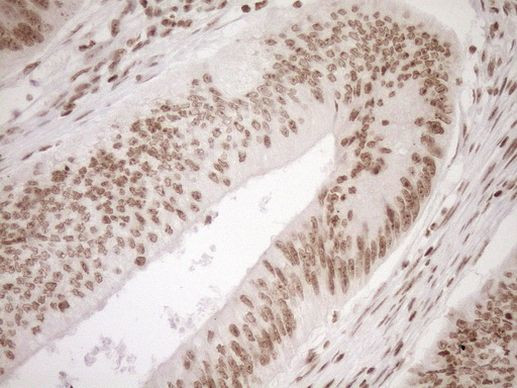 EXOSC1 Antibody in Immunohistochemistry (Paraffin) (IHC (P))