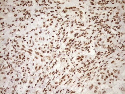 EXOSC1 Antibody in Immunohistochemistry (Paraffin) (IHC (P))