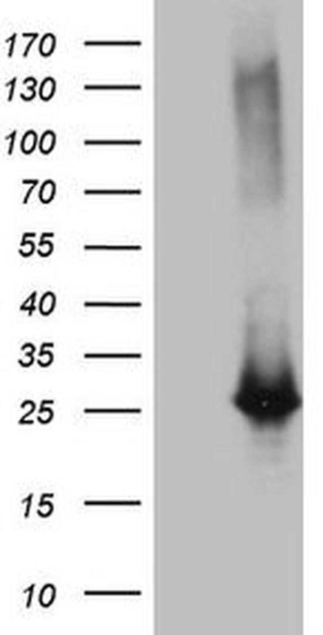 EXOSC1 Antibody in Western Blot (WB)