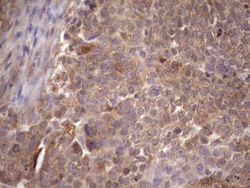 CHMP5 Antibody in Immunohistochemistry (Paraffin) (IHC (P))