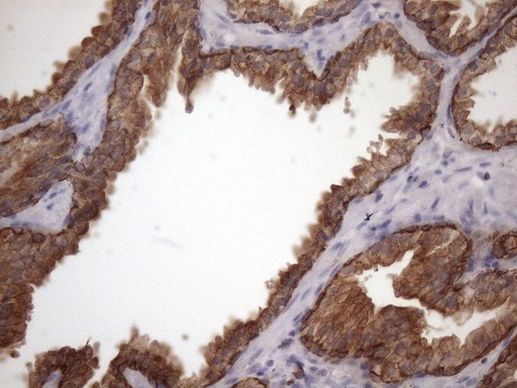 AMTN Antibody in Immunohistochemistry (Paraffin) (IHC (P))