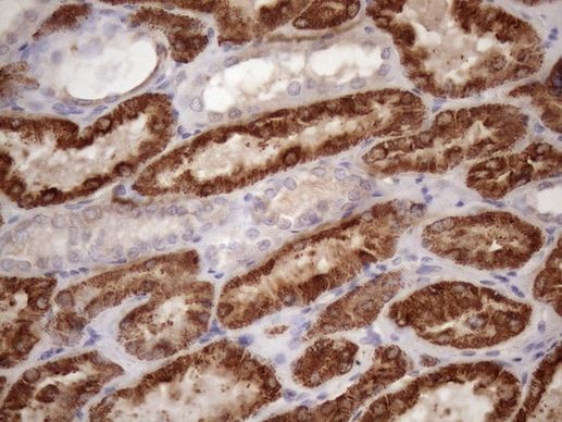 GLYAT Antibody in Immunohistochemistry (Paraffin) (IHC (P))