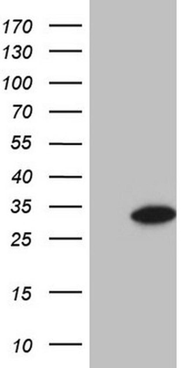 GLYAT Antibody in Western Blot (WB)