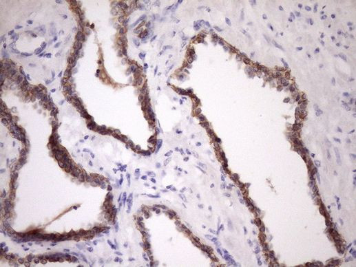 MCEE Antibody in Immunohistochemistry (Paraffin) (IHC (P))